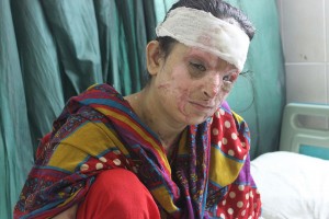Thousands of young women around the world who have survived acid attacks are forced to live with physical, psychological and social scars. Credit: Zofeen Ebrahim/IPS