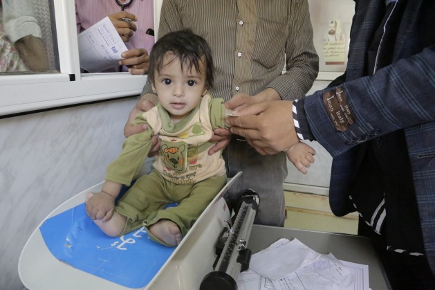 On 6 May 2016 in Yemen, a baby is screened for malnutrition at the UNICEF- supported Al-Jomhouri Hospital in Sa’ada. Credit: UNICEF/UN026928/Al-Zekri